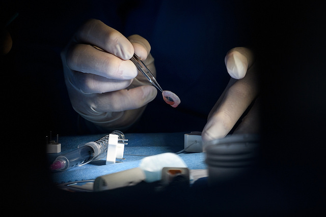 Orbis – Procedure